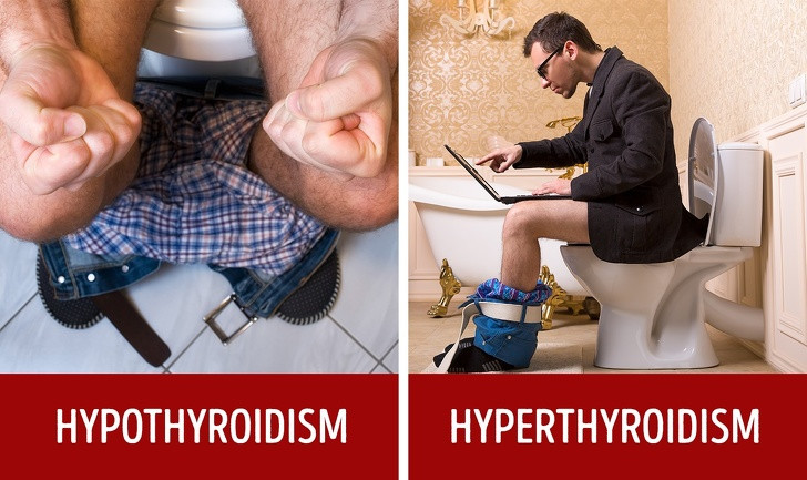Hoạt động của ruột bất thường: Hormone tuyến giáp điều hòa hoạt động ruột. Tuyến giáp hoạt động kém có thể gây ra táo bón, trong khi tuyến giáp hoạt động quá mức có thể dẫn đến sự đi tiêu thường xuyên.
