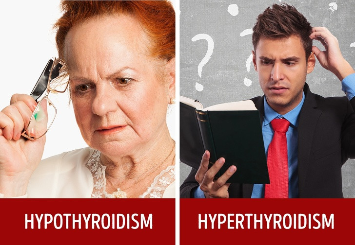 Vấn đề não/khó tập trung: Nếu tuyến giáp có vấn đề, bộ não của bạn cũng bị ảnh hưởng. Tuyến giáp hoạt động kém có thể gây mất trí nhớ, gây khó tập trung.