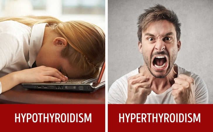 Trầm cảm/lo lắng đột ngột: Nếu bạn cảm thấy lo lắng hoặc tâm trạng không ổn định, có khả năng tuyến giáp của bạn đang có vấn đề.