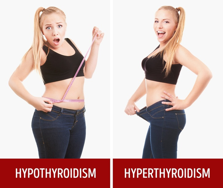 Tăng hoặc giảm cân bất thường: Hormone tuyến giáp có trách nhiệm điều chỉnh sự trao đổi chất của cơ thể. Điều này chính là nguyên nhân khiến bạn tăng hoặc giảm cân đột ngột.