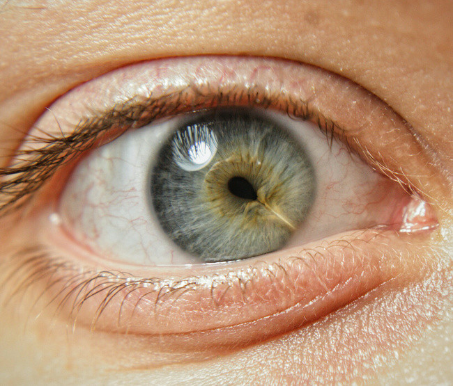 Mắt của người này có một vầng sáng tròn bên trong.