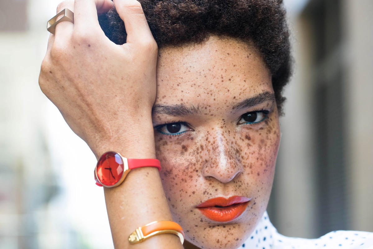 Nikia Phoenix, một người mẫu da màu với khuôn mặt đầy tàn nhang, điều này làm cô trở nên khác lạ.