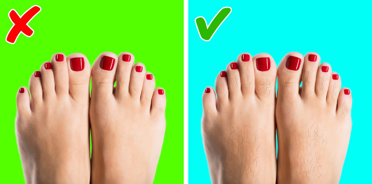 Chân không có lông: Bàn chân nhẵn nhụi không có lông là dấu hiệu của các vấn đề nghiêm trọng về lưu thông máu. Theo Tổ chức chuyên cung cấp dịch vụ chăm sóc sức khỏe tại Anh - NHS - tình trạng này thường được gây ra bởi bệnh tim mạch.