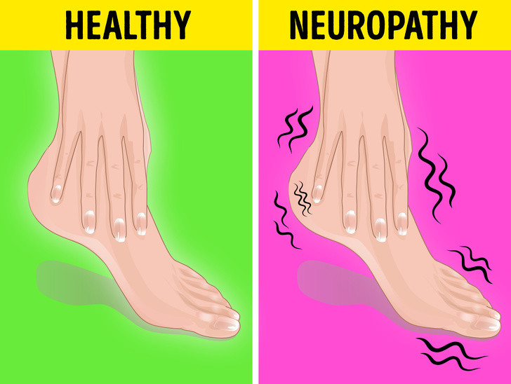 Chân bị tê: Nếu bạn bị mất cảm thấy giác đau ở bàn chân, thường bị ngứa ran/tê... hãy đi khám bác sĩ bởi có thể bạn đã mắc bệnh tiểu đường.