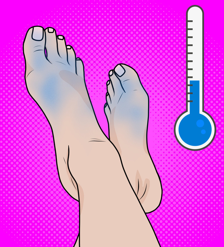 Bàn chân lạnh có thể là một dấu hiệu rối loạn chức năng tuyến giáp. Thiếu máu lưu thông đến các chi như bàn tay và bàn chân cũng có thể dẫn đến lạnh tay và chân hoặc là nhiễm nấm mãn tính.