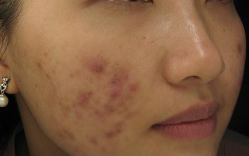 Da sần sùi là dấu hiệu bạn cần phải chăm sóc ngay.