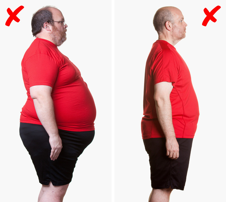 Nguyên nhân mắc bệnh gout có thể bắt nguồn từ một số lý do như thừa cân. Không phải ai béo phì cũng bị gout, nhưng tỷ lệ bị gout ở người thừa cân luôn cao hơn. Lý do là vì cơ thể nặng nề khiến nồng độ insulin tăng, dẫn tới quá trình loại bỏ acid uric sẽ bị chậm dần lại, gây ra bệnh gout.