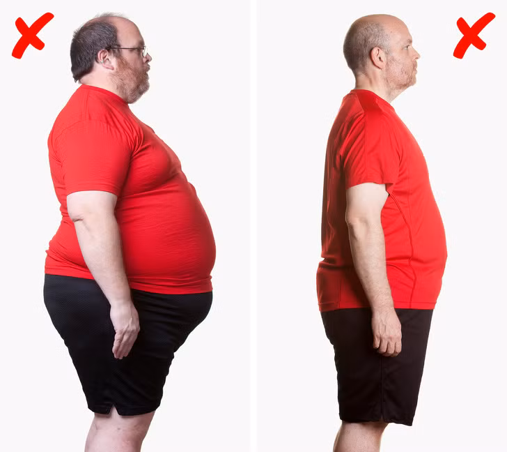 Nguyên nhân mắc bệnh gout có thể bắt nguồn từ một số lý do như thừa cân. Không phải ai béo phì cũng bị gout, nhưng tỷ lệ bị gout ở người thừa cân luôn cao hơn. Lý do là vì cơ thể nặng nề khiến nồng độ insulin tăng, dẫn tới quá trình loại bỏ acid uric sẽ bị chậm dần lại, gây ra bệnh gout.