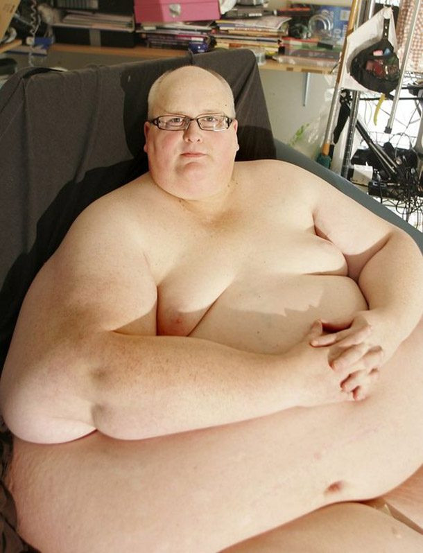 Paul Mason, từng là người béo nhất thế giới, nặng 444kg. Tuy nhiên, sau khi phẫu thuật dạ dày, ông bắt đầu giảm cân.