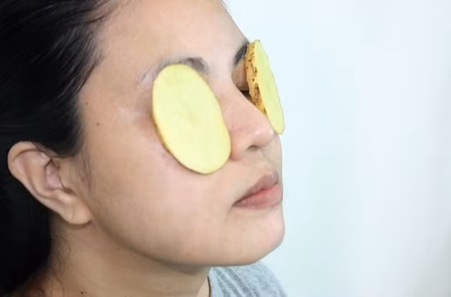 Khoai tây giúp bạn giảm bọng mắt cực nhanh.