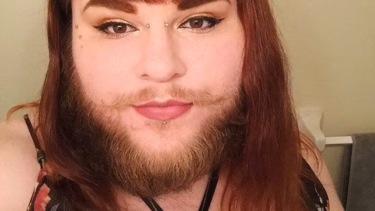 Khuôn mặt gần đây củ Nova sau nhiều tháng không cạo râu.