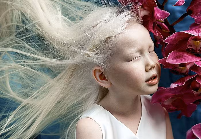 Nhờ vẻ đẹp độc đáo, Nariyana hiện thu hút sự chú ý của nhiều nhiếp ảnh gia và công ty người mẫu.