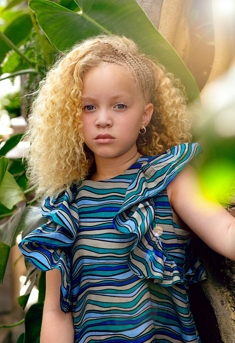 Một số bác sĩ cho rằng Ava còn có thể bị mù nhưng may mắn thay, hiện cô bé vẫn có thể đọc, múa ba-lê và tạo dáng cực tốt trước ống kính.