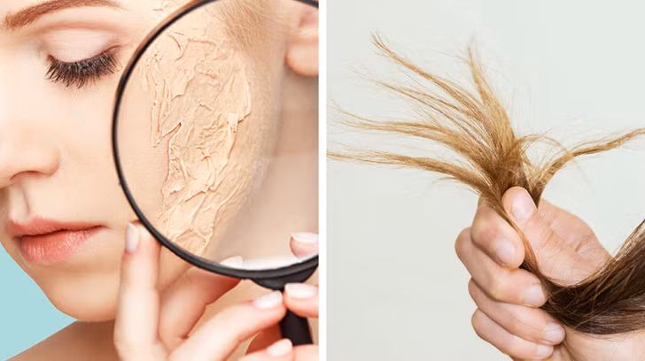 Khi da và tóc thiếu sắt, chúng trở nên khô và dễ gãy hơn. Thiếu sắt làm tăng tỷ lệ rụng tóc, đặc biệt là ở phụ nữ mãn kinh.