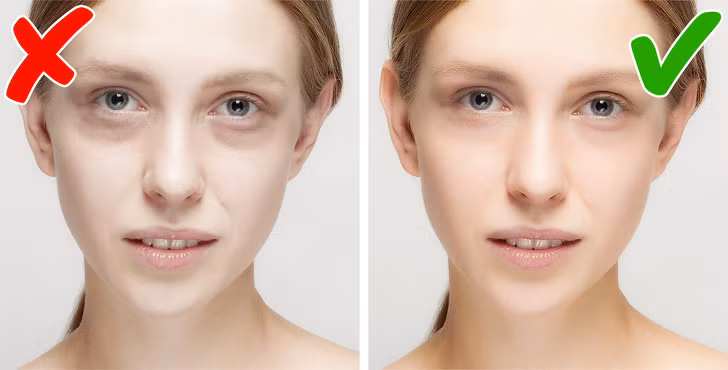 Da nhợt nhạt: Khi thiếu sắt, da bạn sẽ trở nên xanh xao, thiếu sức sống. Nếu bên trong môi, lợi hoặc bên trong mí mắt bạn cũng nhợt nhạt thì đó là dấu hiệu thiếu sắt.