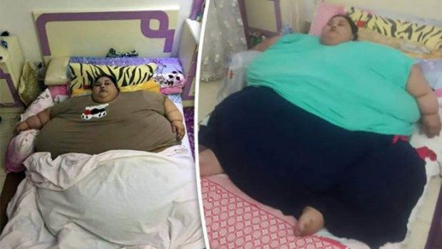 Eman Ahmed Abd El Aty, được cho là một trong những phụ nữ nặng nhất thế giới, nặng 498kg. Cô qua đời ở tuổi 37 do suy tim và suy thận.