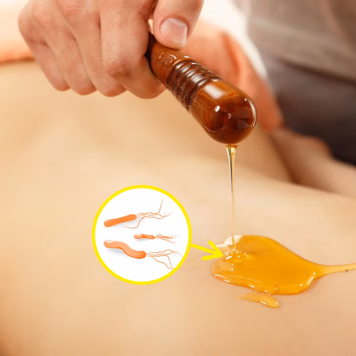 Mật ong giúp điều trị phát ban, bỏng, loét và vết thương khác. Thoa mật ong lên vùng da có vấn đề và để yên trong 30 phút.