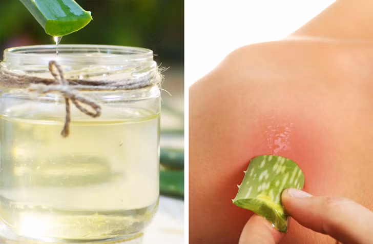 Gel lô hội giúp giảm cháy nắng và chữa lành vết thương. Ngoài ra, nó còn có tác dụng giảm ngứa và kích ứng da. Lấy nửa cốc gel lô hội tươi và sử dụng miếng bông thấm rồi thoa lên da và để khô. Lặp lại 3 lần mỗi ngày.