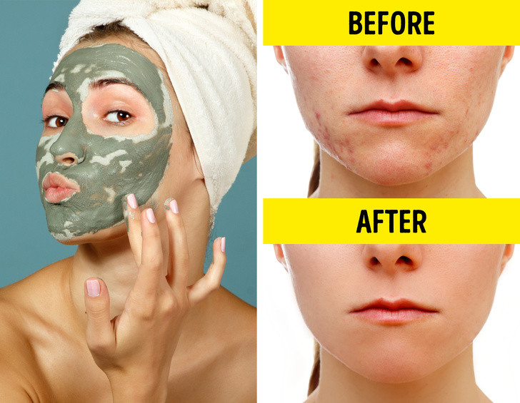 Đất sét Bentonite giúp loại bỏ độc tố, giảm viêm da. Đắp mặt nạ đất sét trong 15-20 phút trước khi rửa bằng nước ấm. Sau đó, bôi kem dưỡng ẩm. Ảnh: BS.