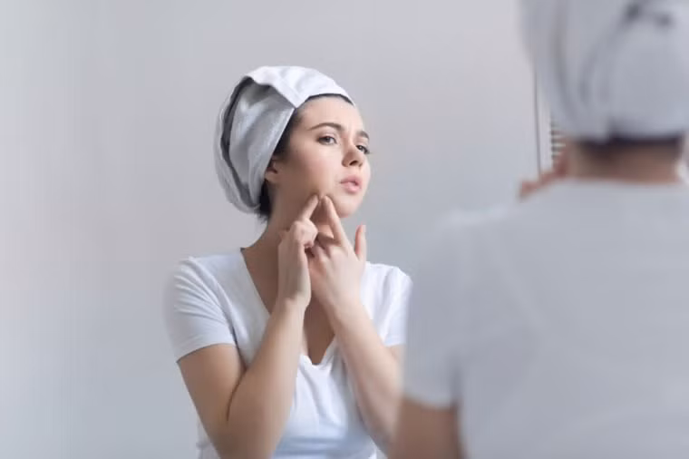 Da nhờn, nổi mụn: Rất nhiều mẹ bầu phải trải qua giai đoạn da bỗng trở nên bóng nhờn và rất dễ nổi mụn. Đó là kết quả của quá trình tăng hormone, kích thích da tiết nhiều bã nhờn và dầu, làm tắc nghẽn lỗ chân lông khiến da bị nhờn và có mụn.