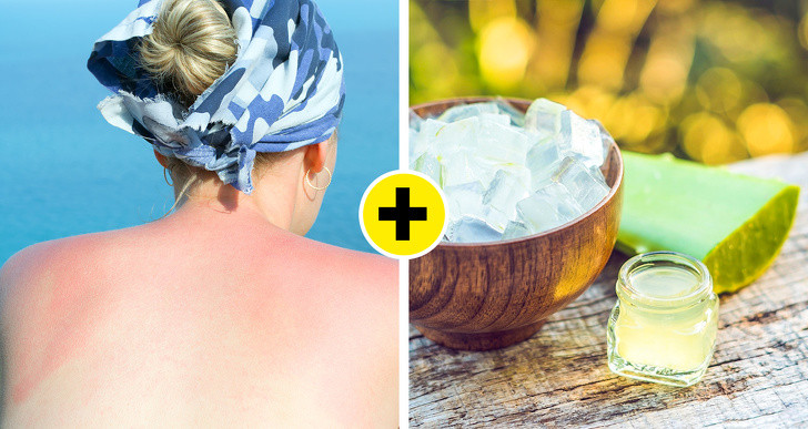 Du lịch mùa hè thường khiến làn da rám nắng. Để làm dịu da đỏ ửng bị kích ứng, bạn nên đóng đá gel lô hội và bôi lên vết rám da.