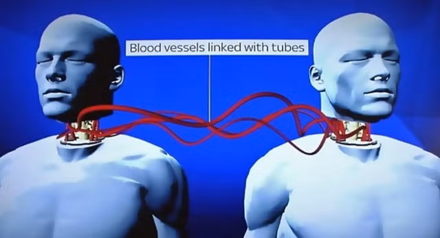 4. Khoa học viễn tưởng sẽ không còn là tưởng tượng: Cuối năm 2017, giáo sư điên người Ý Sergio Canavero tuyên bố thử nghiệm thành công ca ghép đầu người trên xác chết đầu tiên. Theo lộ trình dự tính, kết quả của tuyên bố trước đó sẽ được đưa vào năm 2018. Ngoài ra, bác sĩ Ira Pasto cũng hứa hẹn về những thử nghiệm đầu tiên trong việc đảo ngược quá trình chết não. Ghép đầu người, hồi sinh người chết -nghe thật viễn tưởng - sẽ có khả năng thành sự thật. Năm 2018 tới, các sáng chế trong việc tạo ra vaccine, chữa khỏi bệnh bại liệt, bệnh béo phì... sẽ có kết quả khả quan.