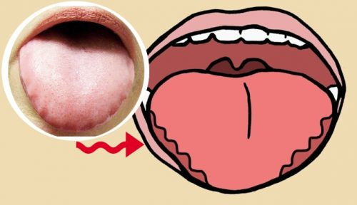 Lưỡi sẽ có màu tái nhợt có thể do cơ thể đang thiếu sắt. Lưỡi sẽ có màu tái nhợt có thể do cơ thể đang thiếu sắt.