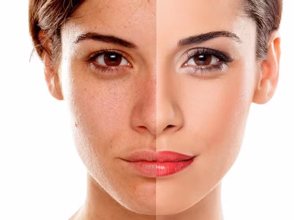 Củ cải đường chứa lutein, chất chống oxy hoá giúp ngăn ngừa các nếp nhăn và làm chậm quá trình lão hóa da, khiến ban trông rạng rỡ và trẻ trung.