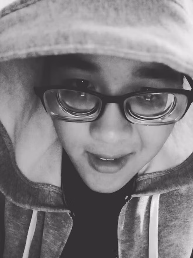 Nhìn giống như anh bạn này đang đeo kính lúp.