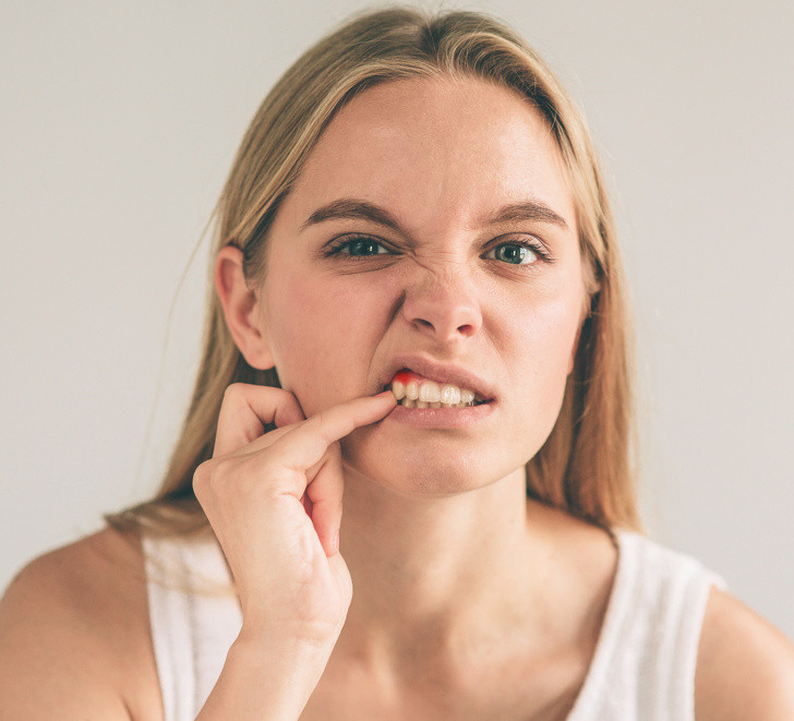 Chảy máu nướu răng: Nếu bạn có vấn đề này, bạn có thể bị thiếu hụt vitamin C. Để cung cấp đủ vitamin C, bạn nên bổ sung trái cây tươi và rau quả.