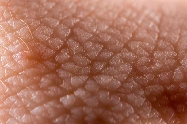 Mặc dù hầu hết các tế bào sẽ chết sau vài giờ nhưng các tế bào da có thể tồn tại rất lâu sau khi bạn qua đời.