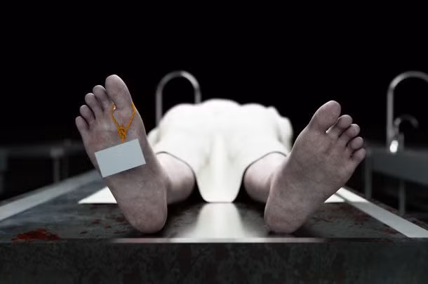 Các nếp nhăn biến mất ngay lập tức khi bạn chết. Các cơ mất đi sức căng nên không thể tạo ra những nếp nhăn trên trán. Ảnh: List25.