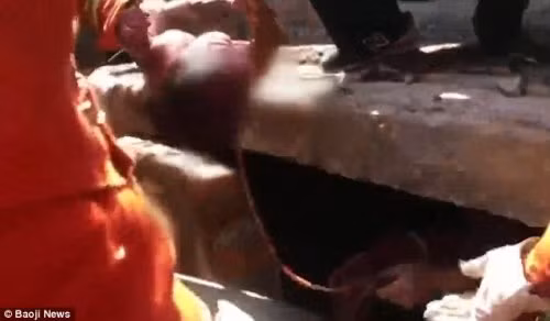 Em bé được cứu ra ngoài trong tình trạng vẫn còn gắn liền với dây rốn và nhau thai.