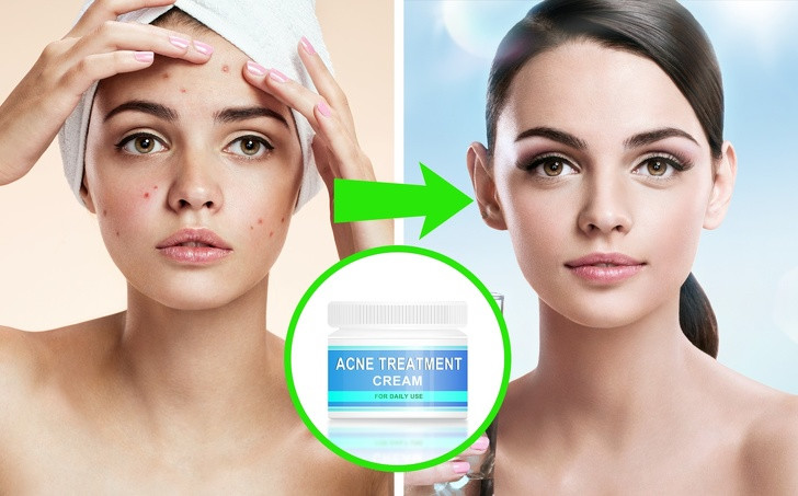 Sử dụng các sản phẩm đặc trị cho vùng da có vấn đề nghiêm trọng như: mụn, tàn nhang, sạm… Sau bước này nên nghỉ 15-30 phút để da cân bằng lại độ pH tự nhiên.