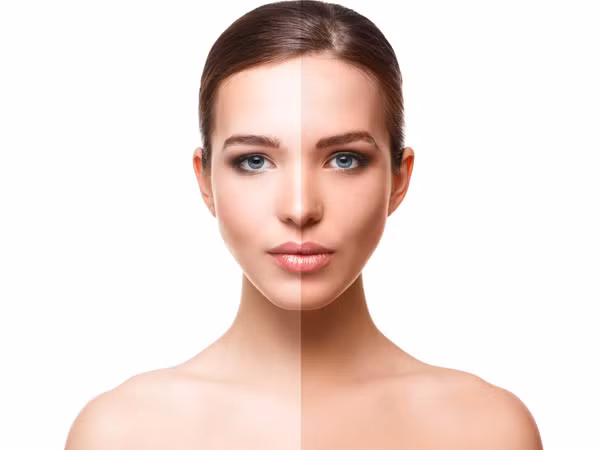 Khắc phục làn da rám nắng bằng nước hoa hồng. Lấy 1 muỗng canh bột mì đổ vào bát, thêm 1 muỗng cà phê chanh và 1 muỗng canh nước hoa hồng để tạo thành bột nhão. Áp dụng hỗn hợp này lên vùng bị ảnh hưởng. Sau 15 phút, rửa sạch bằng nước ấm.