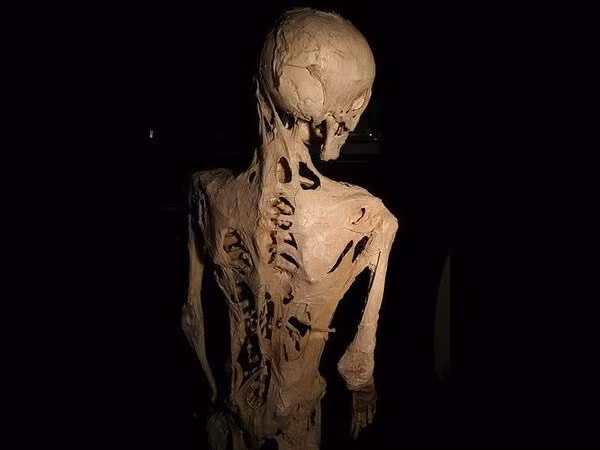 Fibrodysplasia Ossificans Progressiva là một bệnh di truyền đáng sợ gây ra các mô liên kết của cơ thể, như cơ bắp, dây chằng và gân đều hóa thành xương theo thời gian. Không có thuốc chữa cho bệnh này.