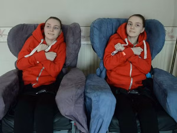 Bệnh thực địa rất hiếm khi chỉ có 2 trường hợp ghi nhận trong lịch sử y khoa là cặp song sinh, Catherine và Kirstie Fields. Đây là bệnh thần kinh cơ gây ra sự thoái hoá nhanh chóng của cơ bắp nhưng không ảnh hưởng đến não bộ. Cặp song sinh bị bệnh này vẫn còn sống (đã 22 tuổi) nhưng họ phải ngồi xe lăn, trợ giúp nói điện tử.