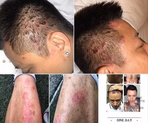 Phong tranh benh quai ac ca si Tuan Hung dang mac phai the nao?-Hinh-2