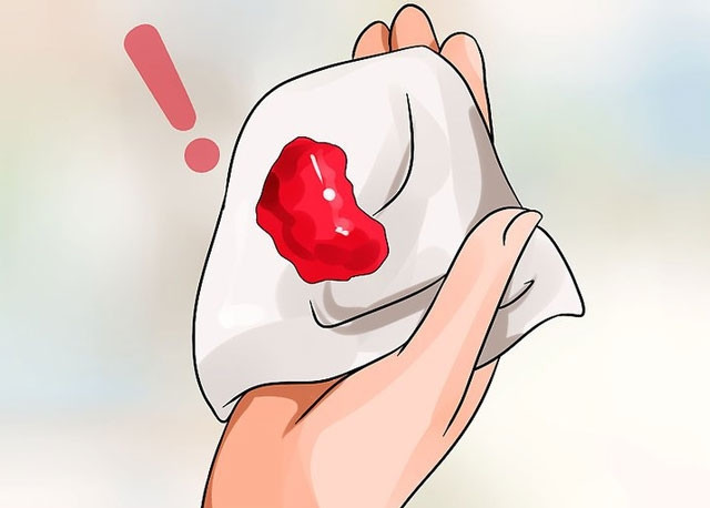 Lượng máu tiết ra nhiều hơn trong chu kỳ kinh nguyệt hay sau khi quan hệ... đi kèm với đó là hiện tượng máu đỏ tươi, lúc ra lúc không kéo dài cũng là một trong các dấu hiệu tiềm ẩn của bệnh ung thư cổ tử cung.