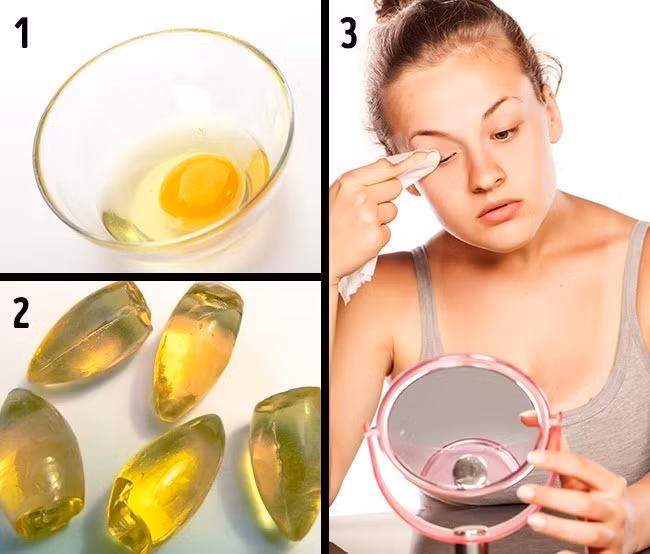Đắp mặt nạ trứng giúp tăng độ dày và ngăn ngừa rụng lông mi. Trộn 1 quả trứng với một thìa canh (khoảng 15ml) glycerin hoặc sáp dưỡng. Lấy khăn mềm hoặc bông cotton thấm hỗn hợp này và thoa nhẹ nhàng lên lông mi. Lặp lại quy trình này 3 lần/tuần hoặc tháng.