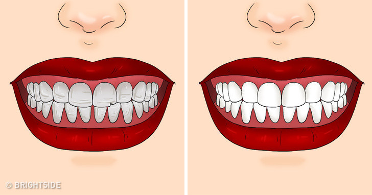 Trong cần tây có một hàm lượng đáng kể chất chống viêm và chống oxy hóa. Những vết viêm tấy trên nướu có thể được xoa dịu nếu chúng ta ăn cần tây đều đặn. Ngoài ra, canxi có trong cần tây còn giúp răng trở nên chắc khỏe và trắng sáng hơn.