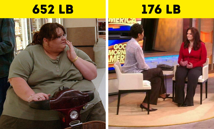 Melissa D. Morris cũng từng nặng gần 300 kg và khó mang thai. Nhờ phẫu thuật dạ dày và chương trình ăn kiêng, tập luyện khắc nghiệt, Melissa đã giảm còn khoảng 80 kg và có thể tự mang thai.