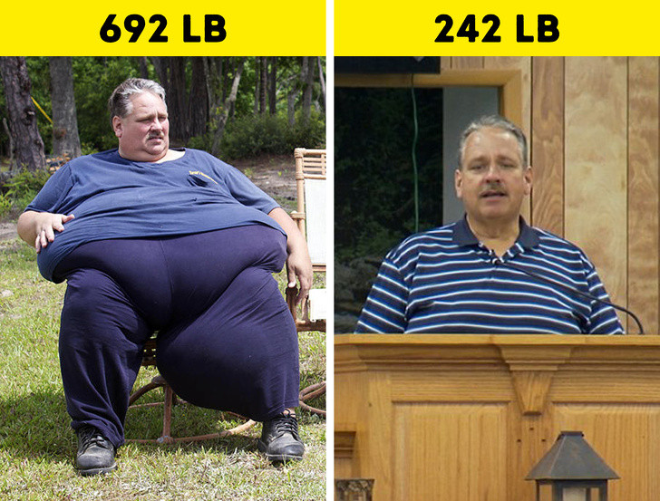 Chuck Turner từng nặng tới 313kg và ông đã giảm được tới 190kg sau khi phẫu thuật khối u ở chân. Giờ, ông ấy đã trở thành một người hoàn toàn khác.