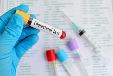 Luôn kiểm tra mức cholesterol tốt (HDL) là cách phòng bệnh tim hữu hiệu. Khi phụ nữ còn trẻ và có nhiều estrogen, mức HDL tự nhiên cao. Trong thời kỳ mãn kinh, con số này tự nhiên giảm nên bạn cần kiểm tra thường xuyên.
