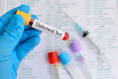 Luôn kiểm tra mức cholesterol tốt (HDL) là cách phòng bệnh tim hữu hiệu. Khi phụ nữ còn trẻ và có nhiều estrogen, mức HDL tự nhiên cao. Trong thời kỳ mãn kinh, con số này tự nhiên giảm nên bạn cần kiểm tra thường xuyên.