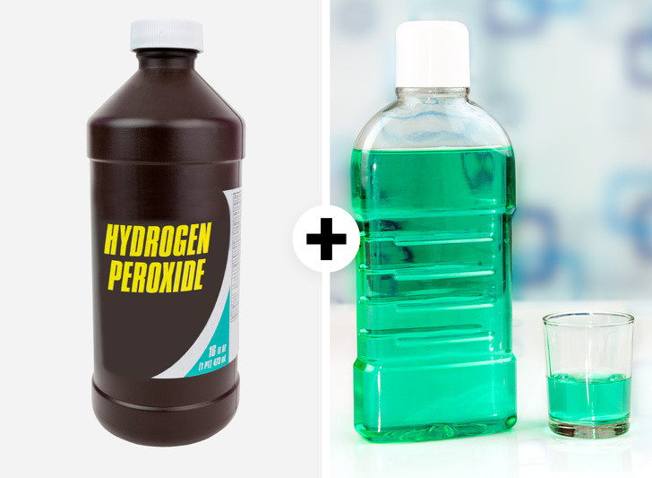 Hydrogen peroxide (nước oxy già) và nước súc miệng: Trộn 1 muỗng canh nước súc miệng sát trùng với 3 muỗng canh dung dịch 3% hydro peroxit. Súc miệng bằng hỗn hợp này trong vài phút và tráng bằng nước sạch để loại bỏ cao răng. 