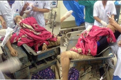 Ngay sau khi bệnh nhân đến viện, các bác sĩ khẩn cấp phẫu thuật cấp cứu, hồi sức cho nạn nhân. Sau hơn 3 giờ cấp cứu, hồi sức tích cực đến sáng ngày hôm sau, bệnh nhân đã tỉnh và tiếp xúc chậm.