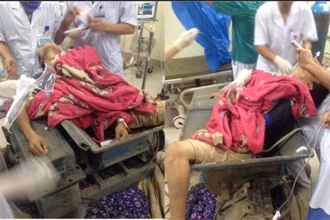 Ngay sau khi bệnh nhân đến viện, các bác sĩ khẩn cấp phẫu thuật cấp cứu, hồi sức cho nạn nhân. Sau hơn 3 giờ cấp cứu, hồi sức tích cực đến sáng ngày hôm sau, bệnh nhân đã tỉnh và tiếp xúc chậm.