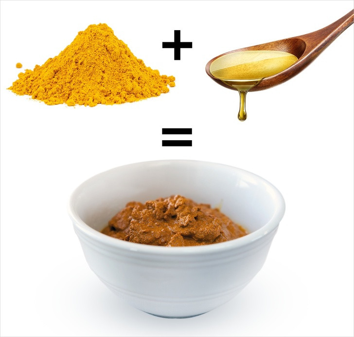 Bột nghệ có chất chống viêm và giảm đau, giúp giảm sưng và đau khi móng chân mọc đâm vào thịt. Trộn 1/2 muỗng cà phê bột nghệ với 1/2 muỗng canh dầu mù tạt. Bôi lên vùng móng chân rồi băng lại khoảng 1 tiếng. Lặp lại quy trình 2-3 lần mỗi ngày.