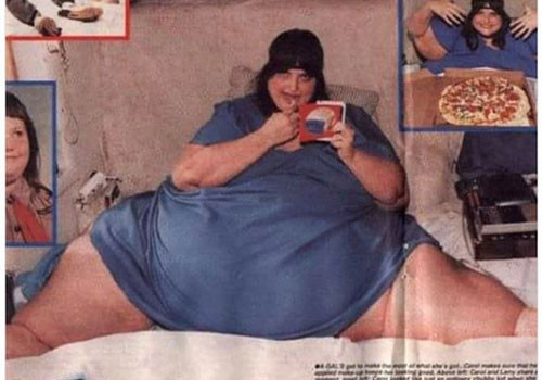 Năm 1993, Carol Yager, 34 tuổi, nặng 539 kg khi các nhân viên cứu hỏa đưa cô đến bệnh viện. Cô đã không di chuyển trong 9 tháng.